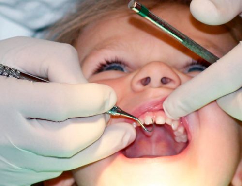 ترمیم و درمان پوسیدگی دندان کودکان