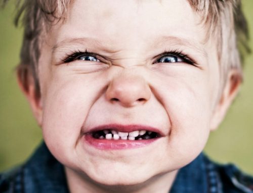 دلایل دندان قروچه در کودکان ؛ درمان دندان قروچه یا براکسیسم (Bruxism)